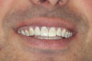 dental case study