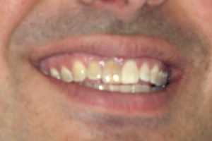 dental case study