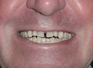dental case study