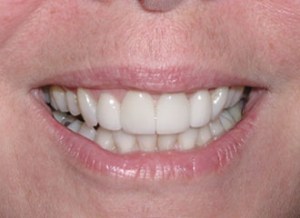 dental case study