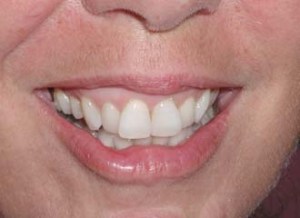 dental case study