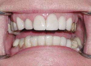 dental case study