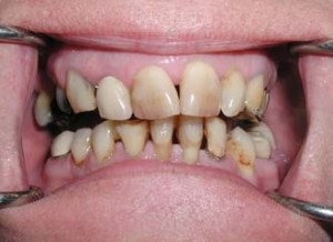 dental case study