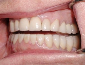dental case study