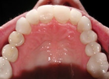 dental case study