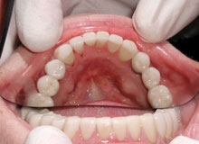 dental case study