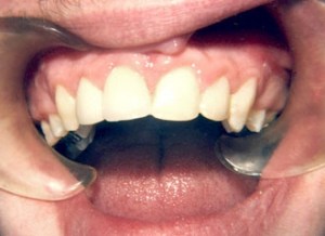 dental case study