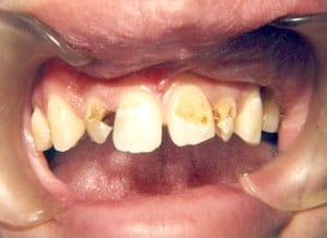 dental case study