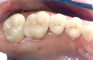 dental case study