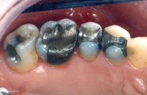 dental case study