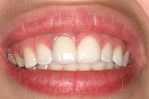 dental case study