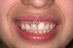 dental case study