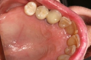 dental case study