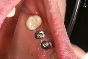 dental case study