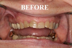 dental case study