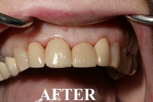dental case study