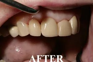 dental case study