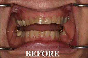 dental case study