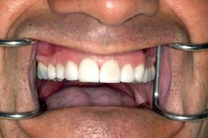 dental case study