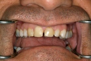 dental case study