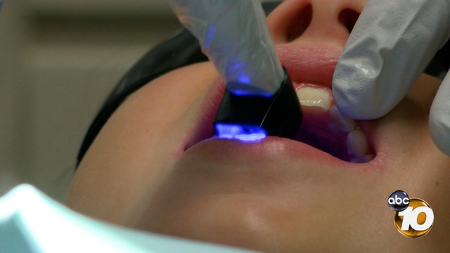 Cam-X Spectra tool being used on a patient