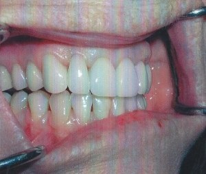 dental case study