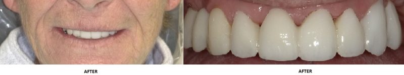 dental case study