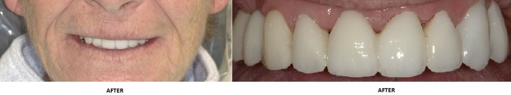 dental case study